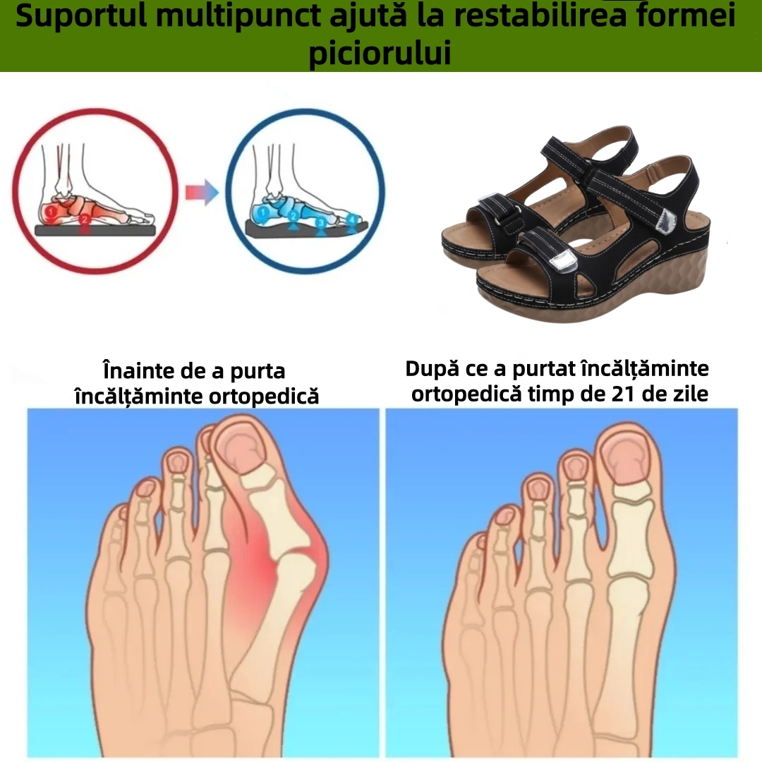 ⏰Ultima zi cu reducere de 70% - Nu rata ocazia!✅️Sandale confortabile cu suport pentru bolta plantară - Design ergonomic