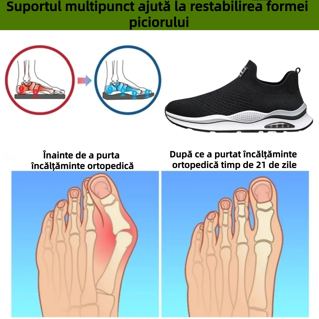 ⏰Ultima zi, reducere de 70% - nu ratați! ✅️Pantofi sport confortabili cu suport pentru bolta plantară - design ergonomic