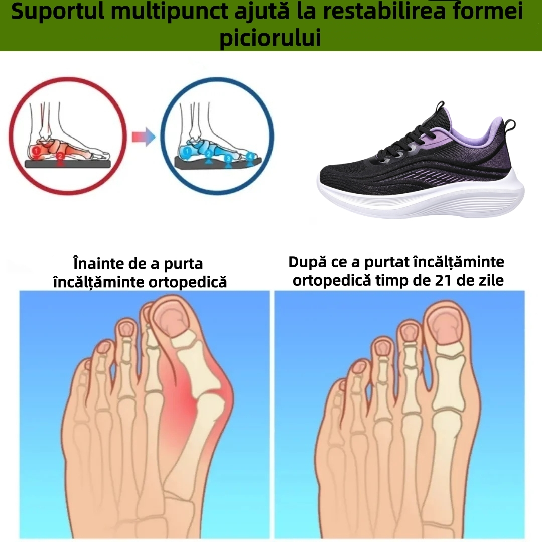 ⏰Ultima zi! Reducere 30% - Nu rata ocazia! ✅️Încălțăminte confortabilă pentru femei cu suport pentru bolta plantară - design ergonomic