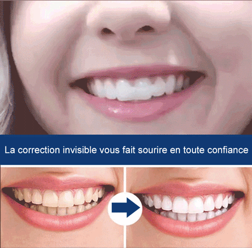 Repose - dents en silicone dents cosmétiques