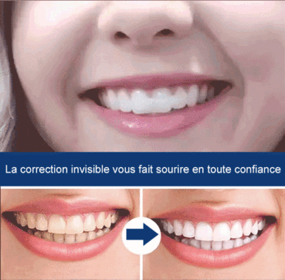 Repose - dents en silicone dents cosmétiques