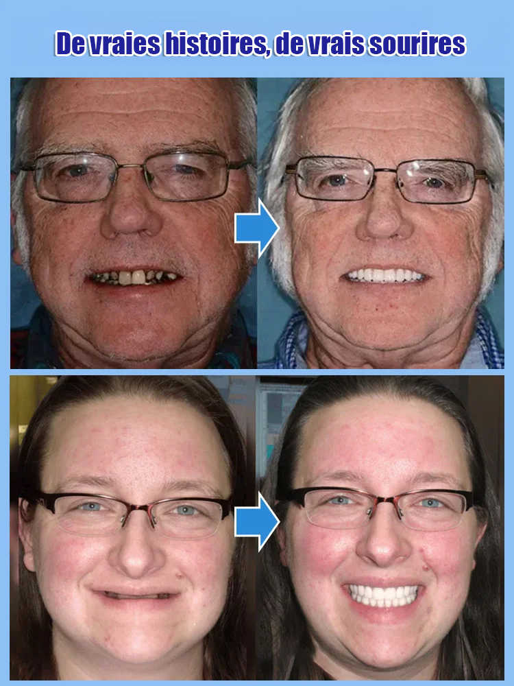 Marre des devis dentaires ? ✨ Souriez à nouveau en 60 secondes ! 🦷