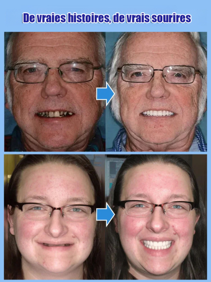 Marre des devis dentaires ? ✨ Souriez à nouveau en 60 secondes ! 🦷