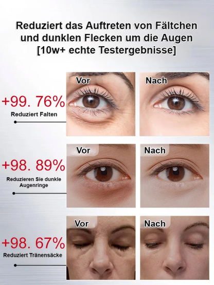 【In führenden Schönheitssalons verwendet】Kräuter-Anti-Falten-Straffungs-Augencreme