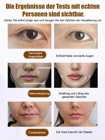 Zellrekombinations-Kollagen-Serum