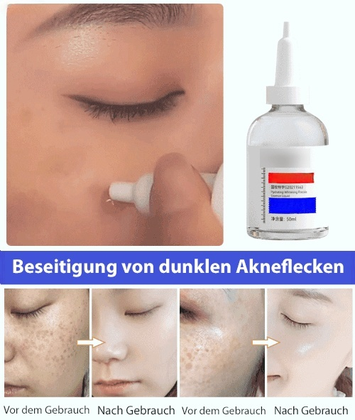 Aufhellendes Serum gegen Hautunreinheiten
