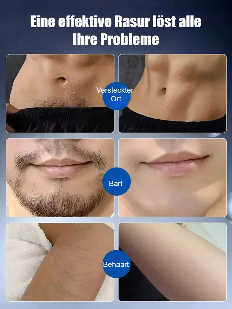 【In Zusammenarbeit mit der Technischen Universität München entwickelt】Intelligenter Sensorelektrorasierer