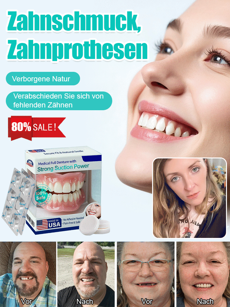 Zahnersatzverblendung