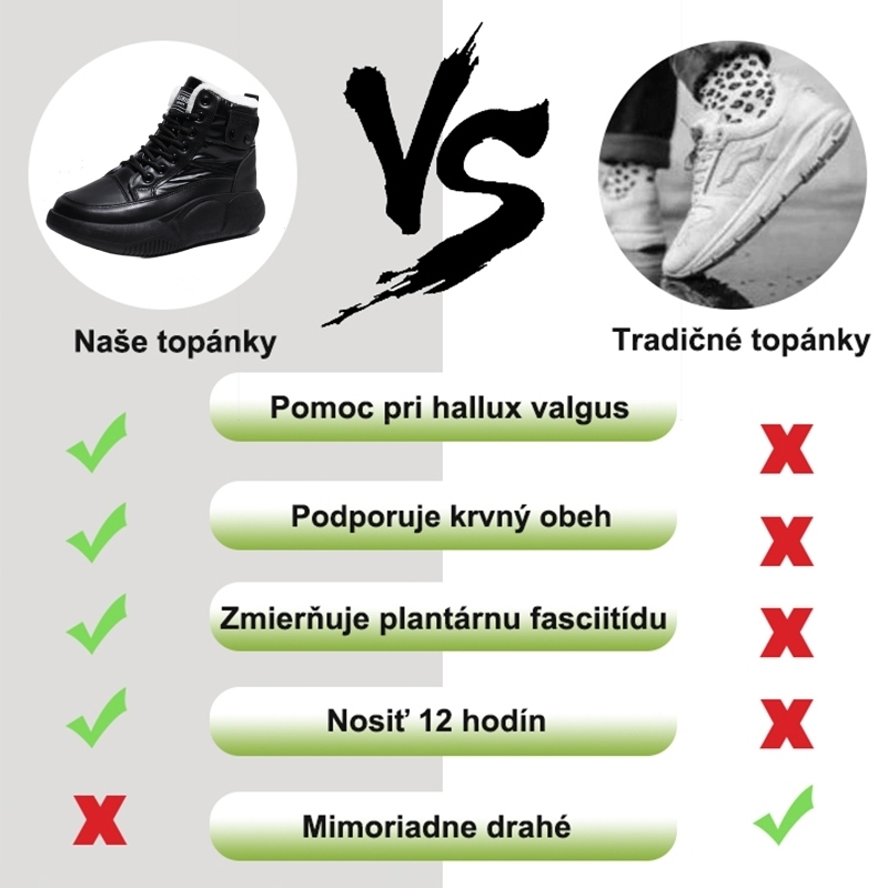 (🔥Dnes zľava 50% - nepremeškajte túto príležitosť) ⏰ - Mäkké a pohodlné vlnené topánky (podpora klenby - uľahčuje chôdzu)