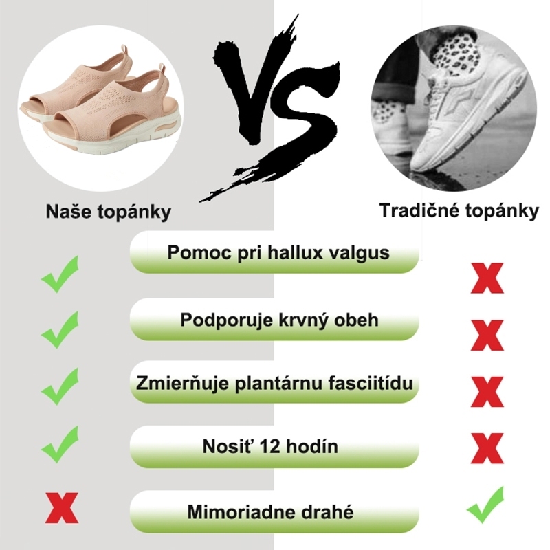 🔥 Časovo obmedzená 50% zľava - ⏰ Letné pohodlné sandále - Zmierňujú bolesti nôh a chrbta - Ergonomický dizajn