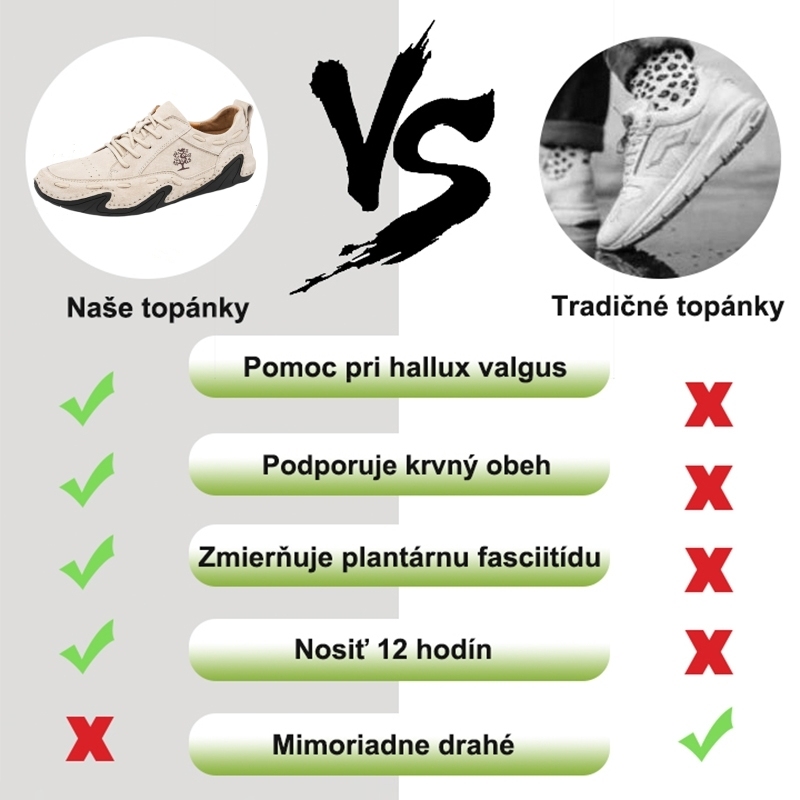 (🔥50% zľava na posledný deň - nepremeškajte to) Ergonomicky navrhnutá ortopedická obuv - ľahko sa zbavíte bolesti nôh👞