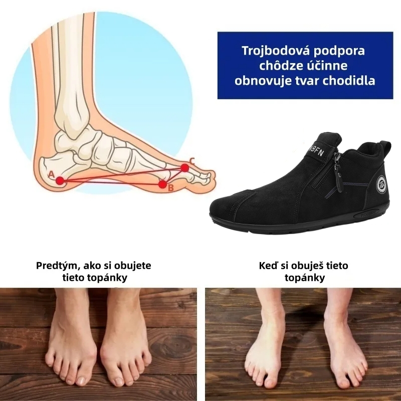 ⏰ Dnes zľava 70 % – Nenechajte si to ujsť! ⬛ – Novo vylepšené ortopedické semišové topánky, mäkké a pohodlné, ľahko sa obúvajú a vyzúvajú, vodeodolné a protišmykové💧  – Zmierňuje bolesť nôh🦶