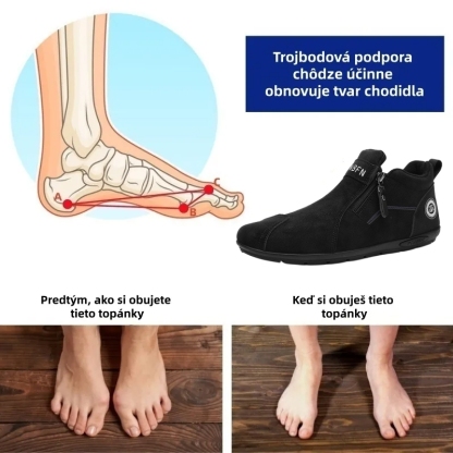 ⏰ Dnes zľava 70 % – Nenechajte si to ujsť! ⬛ – Novo vylepšené ortopedické semišové topánky, mäkké a pohodlné, ľahko sa obúvajú a vyzúvajú, vodeodolné a protišmykové💧  – Zmierňuje bolesť nôh🦶