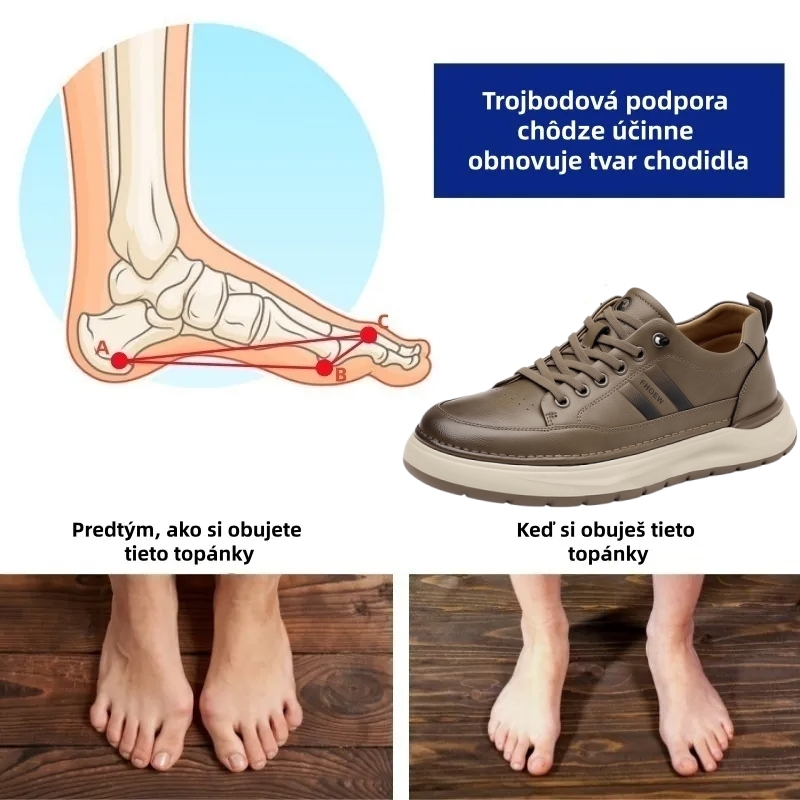 🔷 Dnes zľava 70 % – Nenechajte si to ujsť! ⬛ – Novovyvinuté ortopedické austrálske kožené topánky, mäkké, pohodlné, vodeodolné a protišmykové 🦶 – Zmierňujú bolesť nôh