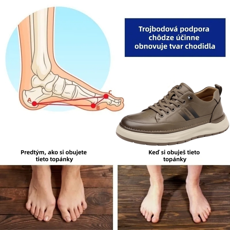 🔷 Dnes zľava 70 % – Nenechajte si to ujsť! ⬛ – Novovyvinuté ortopedické austrálske kožené topánky, mäkké, pohodlné, vodeodolné a protišmykové 🦶 – Zmierňujú bolesť nôh