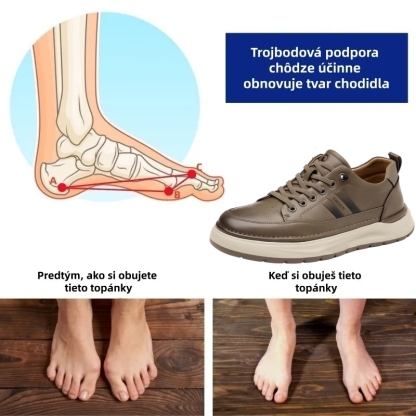 🔷 Dnes zľava 70 % – Nenechajte si to ujsť! ⬛ – Novovyvinuté ortopedické austrálske kožené topánky, mäkké, pohodlné, vodeodolné a protišmykové 🦶 – Zmierňujú bolesť nôh