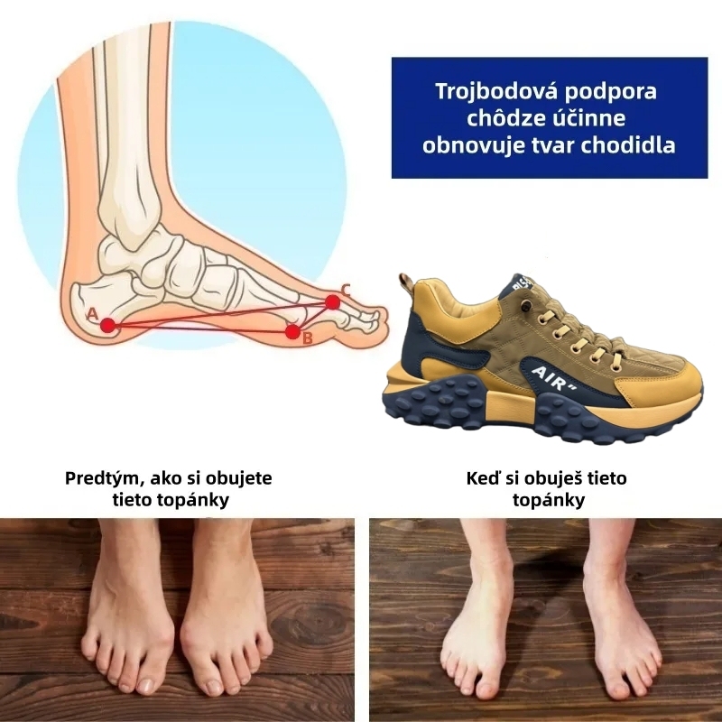 (🔥Posledný deň so zľavou 50 % – nenechajte si to ujsť!) Vylepšená ergonomická ortopedická obuv – ľahko sa zbavte bolesti nôh 👞