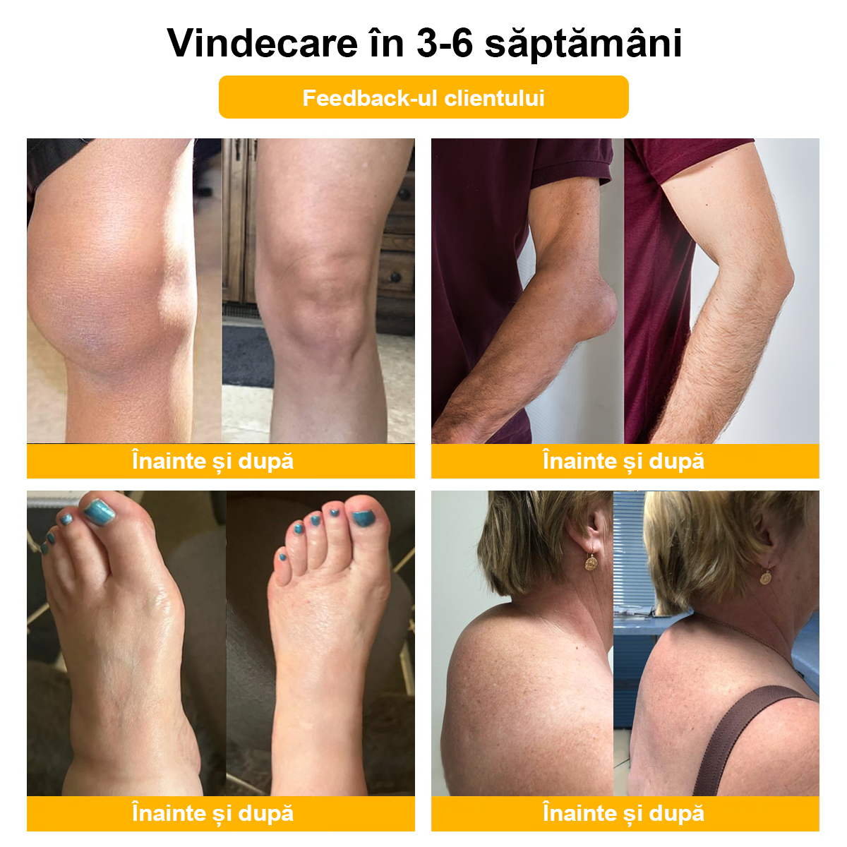 Specializat în afecțiuni ortopedice și dureri articulare 👨⚕️ 𝐹𝐴𝑇𝑂𝑁𝐺™ Cremă pentru artrită cu venin de albine și curcuma🧴🧴