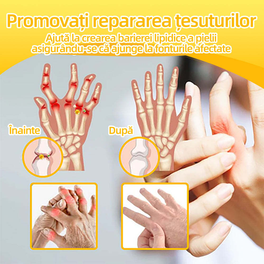 Specializat în afecțiuni ortopedice și dureri articulare 👨⚕️ 𝐹𝐴𝑇𝑂𝑁𝐺™ Cremă pentru artrită cu venin de albine și curcuma🧴🧴