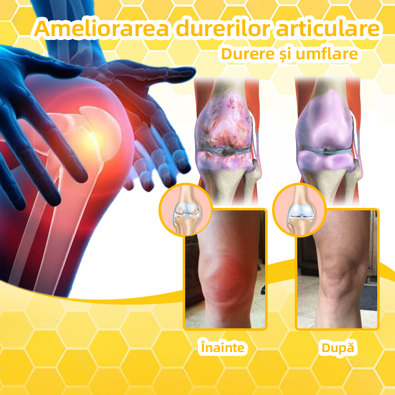 Specializat în afecțiuni ortopedice și dureri articulare 👨⚕️ 𝐹𝐴𝑇𝑂𝑁𝐺™ Cremă pentru artrită cu venin de albine și curcuma🧴🧴