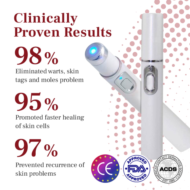 Poiultd® LumeSkin Mole and Wart Removal Laser Pen ❤️-POIULTD