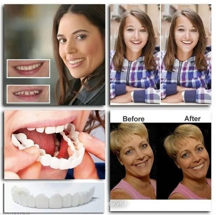 🔥🔥Last day discount-(50%off)- Adjustable dentures