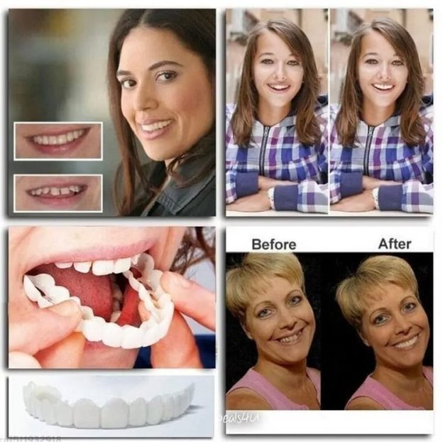 🔥🔥Last day discount-(50%off)- Adjustable dentures