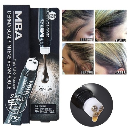 🔥Hot sale-49%OFF--SCALP INTENSE - HAIR GROWTH SERUM