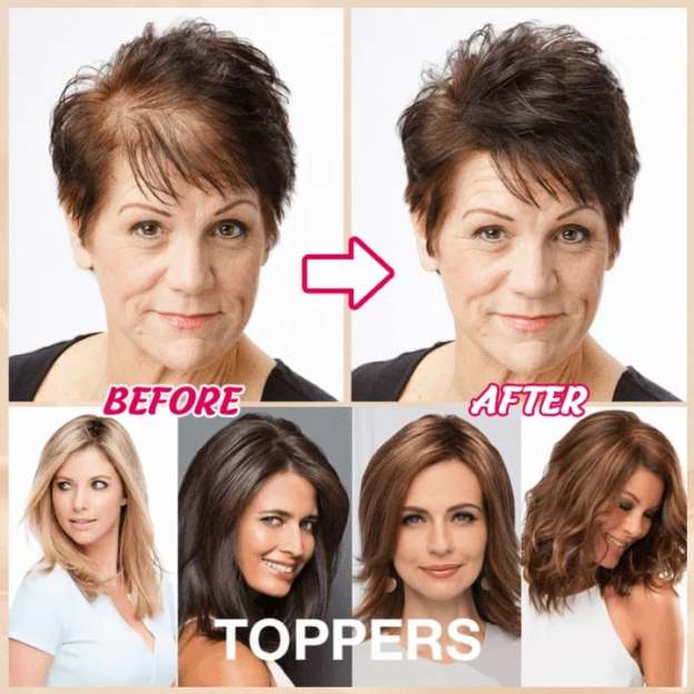 🔥Breathable and natural hair toppers for women with thinning hair-POIULTD