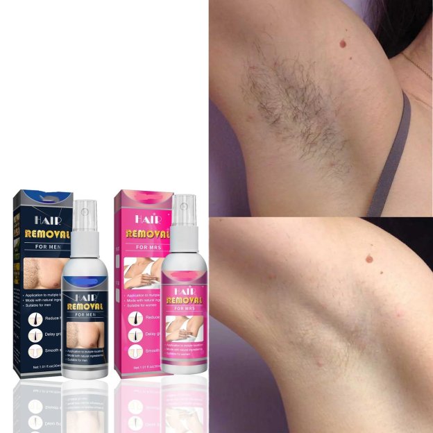 Body Hair Removal Spray🔥🔥🔥BUY 2 GET 2 FREE(4PCS)🔥🔥🔥