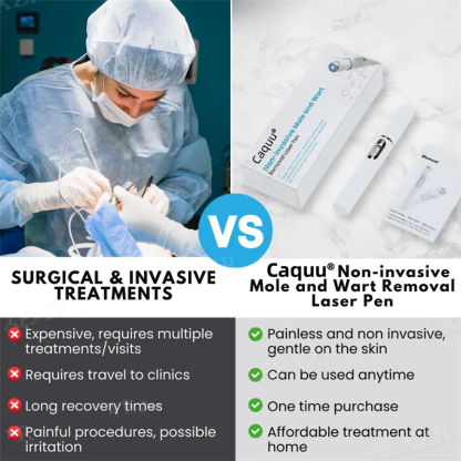 Caquu® Non-Invasive Mole and Wart Removal Laser Pen