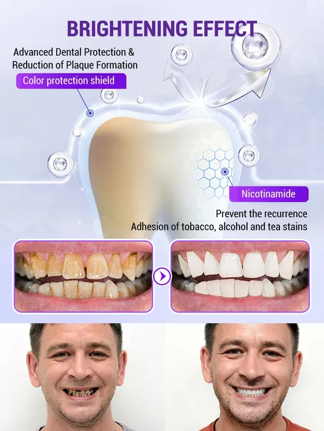 Niooe®Dental cleaning powder