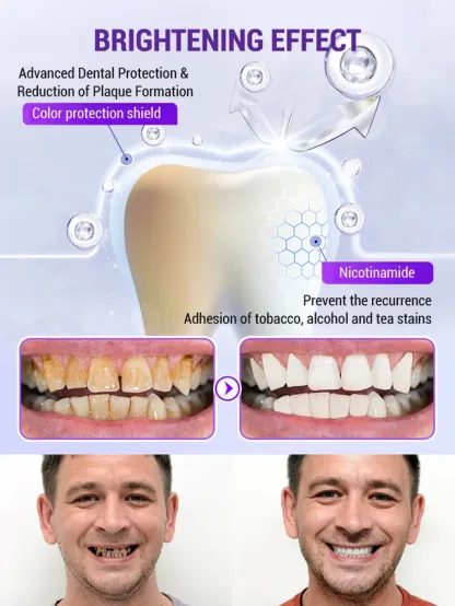 Niooe®Dental cleaning powder