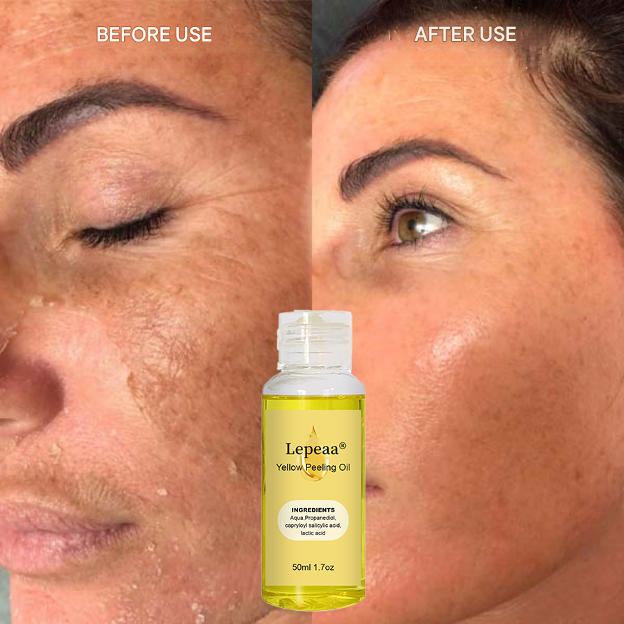 Lepeaa® Yellow Peeling Oil