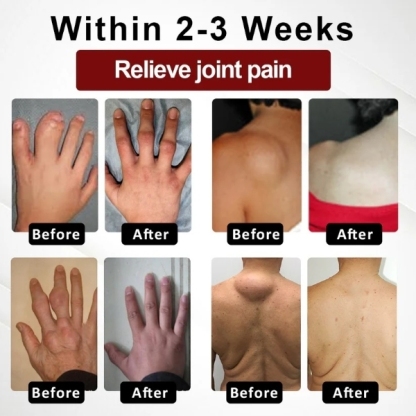 Lepeaa™ Horse Chestnut Arthritis Massage Cream