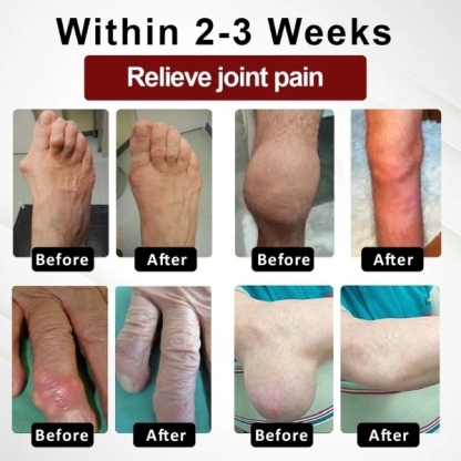 Lepeaa™ Horse Chestnut Arthritis Massage Cream