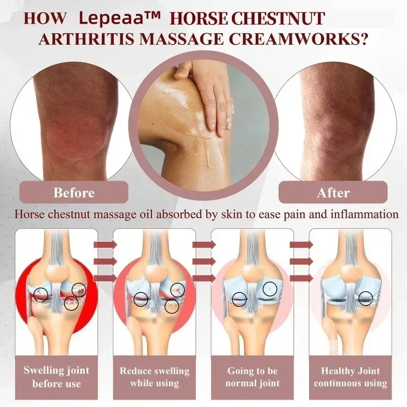 Lepeaa™ Horse Chestnut Arthritis Massage Cream