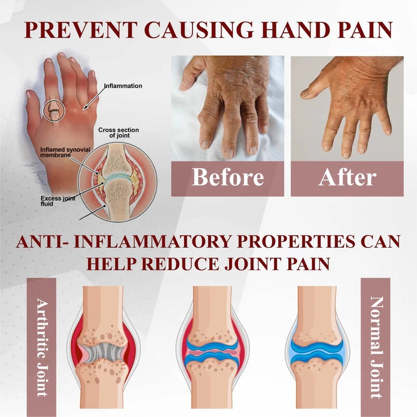 Lepeaa™ Horse Chestnut Arthritis Massage Cream