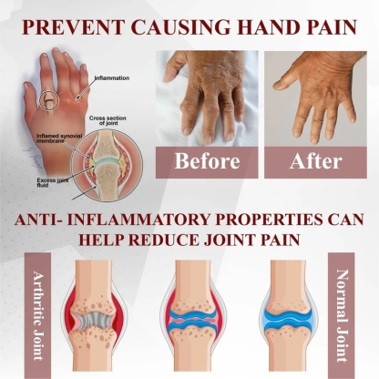 Lepeaa™ Horse Chestnut Arthritis Massage Cream