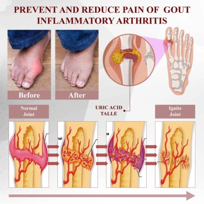 Lepeaa™ Horse Chestnut Arthritis Massage Cream
