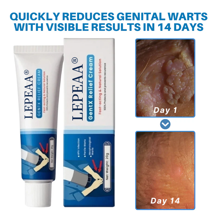 LEPEAA® HPV Genital Warts Relief Cream