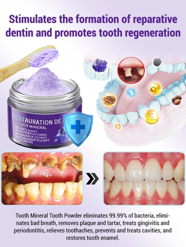 Niooe®Dental cleaning powder