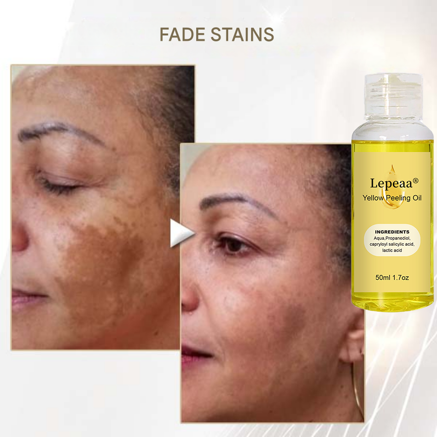 Lepeaa® Yellow Peeling Oil