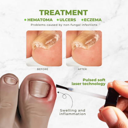 Lepeaa™ Nourishglow Nail Care Oil
