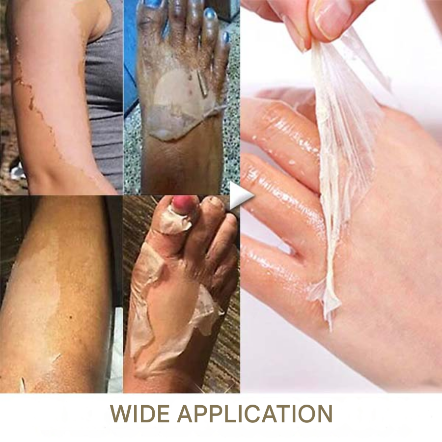 Lepeaa® Yellow Peeling Oil