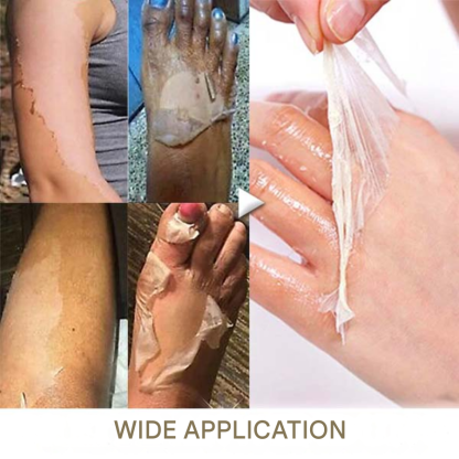Lepeaa® Yellow Peeling Oil