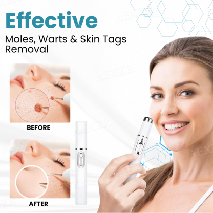 Caquu® Non-Invasive Mole and Wart Removal Laser Pen