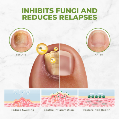 Lepeaa™ Nourishglow Nail Care Oil