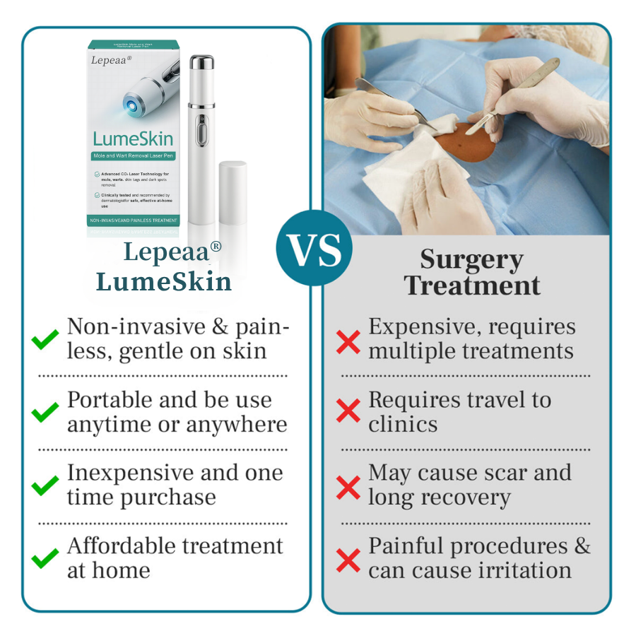 Lepeaa® LumeSkin Mole and Wart Removal Laser Pen