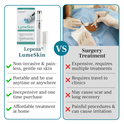 Lepeaa® LumeSkin Mole and Wart Removal Laser Pen